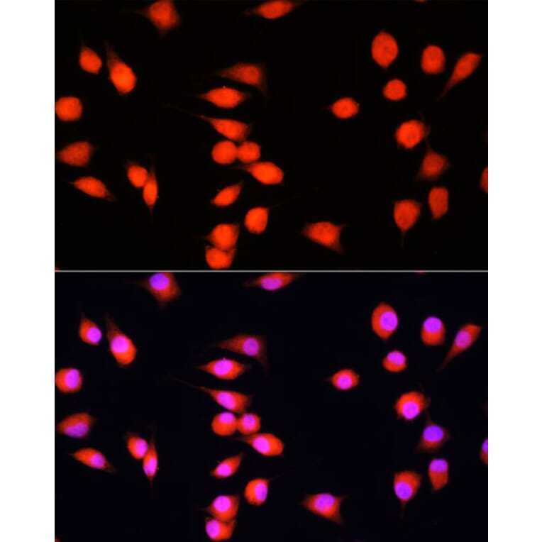 Immunofluorescence - Anti-COMMD1 / MURR1 Antibody (A10068) - Antibodies.com