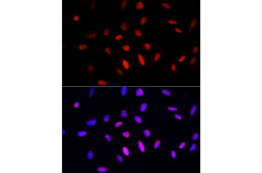 Immunofluorescence - Anti-COMMD1/MURR1 Antibody (A10068) - Antibodies.com