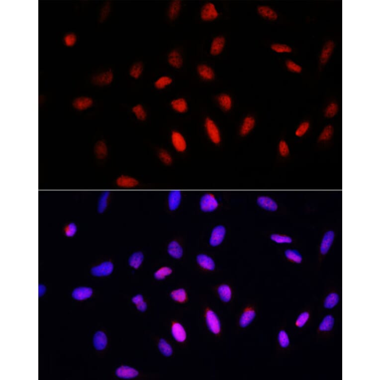 Immunofluorescence - Anti-COMMD1 / MURR1 Antibody (A10068) - Antibodies.com