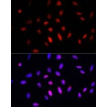 Immunofluorescence - Anti-COMMD1 / MURR1 Antibody (A10068) - Antibodies.com