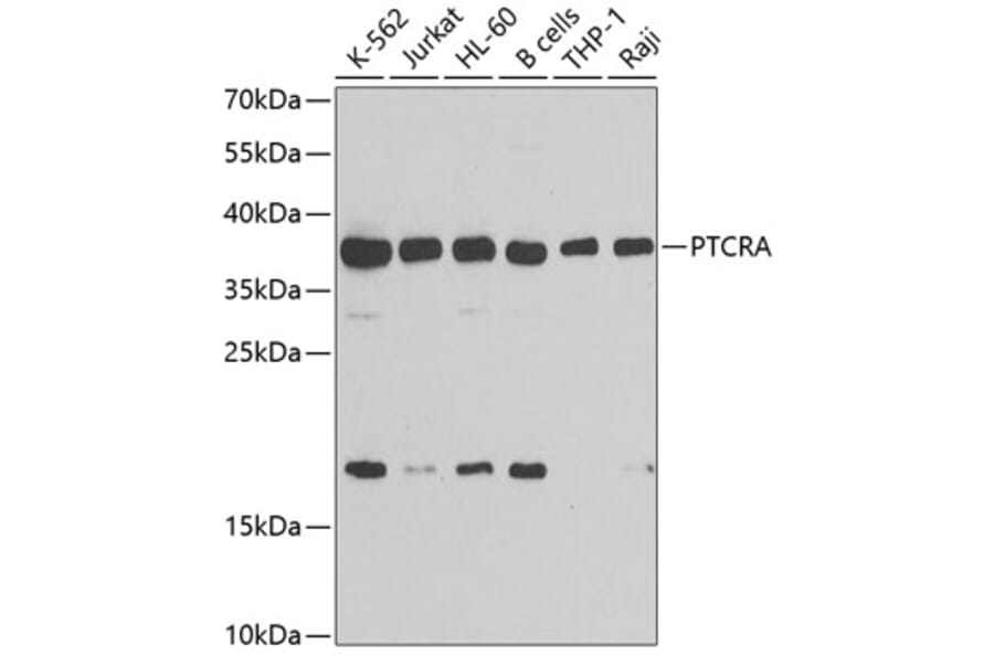 Western Blot - Anti-PTCRA Antibody (A10069) - Antibodies.com