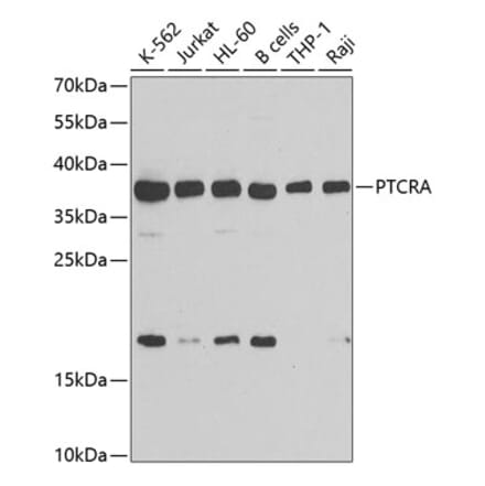 Western Blot - Anti-PTCRA Antibody (A10069) - Antibodies.com