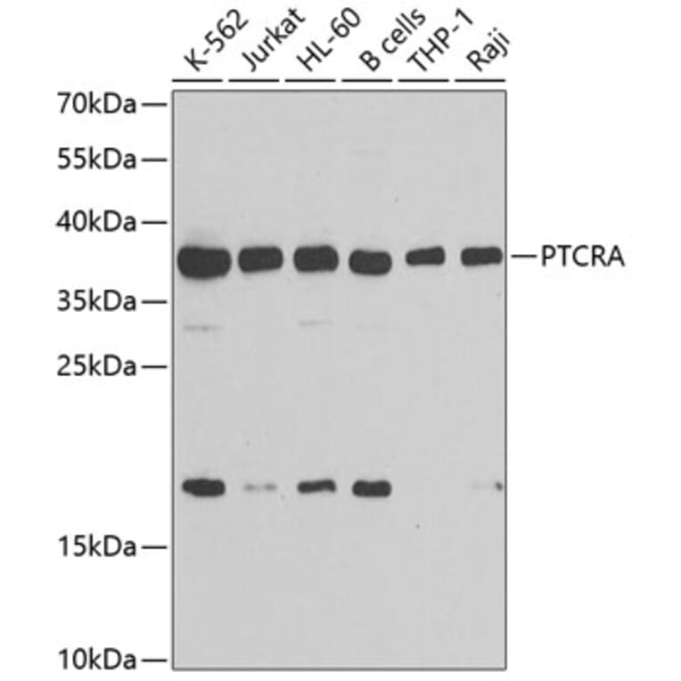 Western Blot - Anti-PTCRA Antibody (A10069) - Antibodies.com