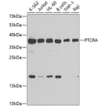 Western Blot - Anti-PTCRA Antibody (A10069) - Antibodies.com