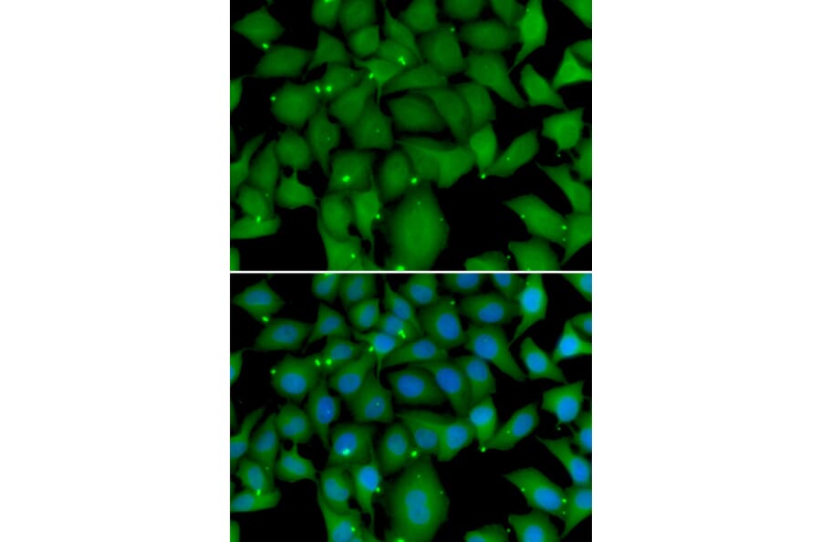 Immunofluorescence - Anti-BCL2L15 Antibody (A7156) - Antibodies.com