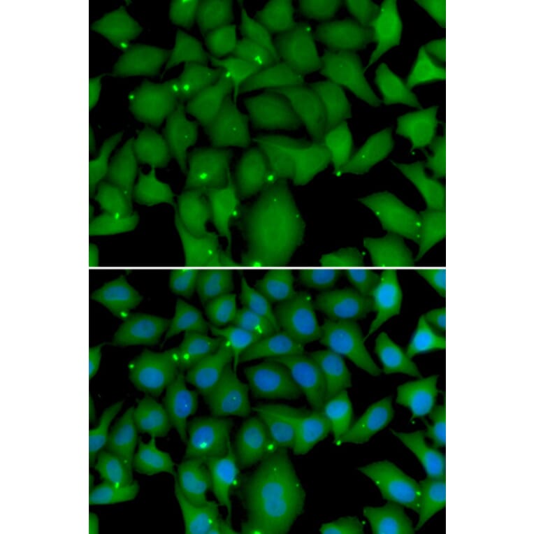 Immunofluorescence - Anti-BCL2L15 Antibody (A7156) - Antibodies.com