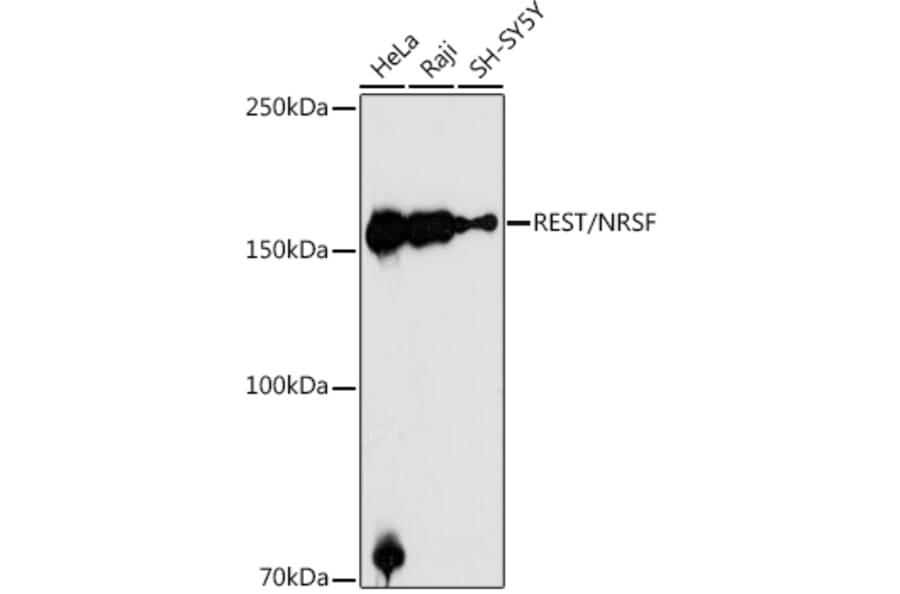 Western Blot - Anti-REST/NRSF Antibody (A10072) - Antibodies.com