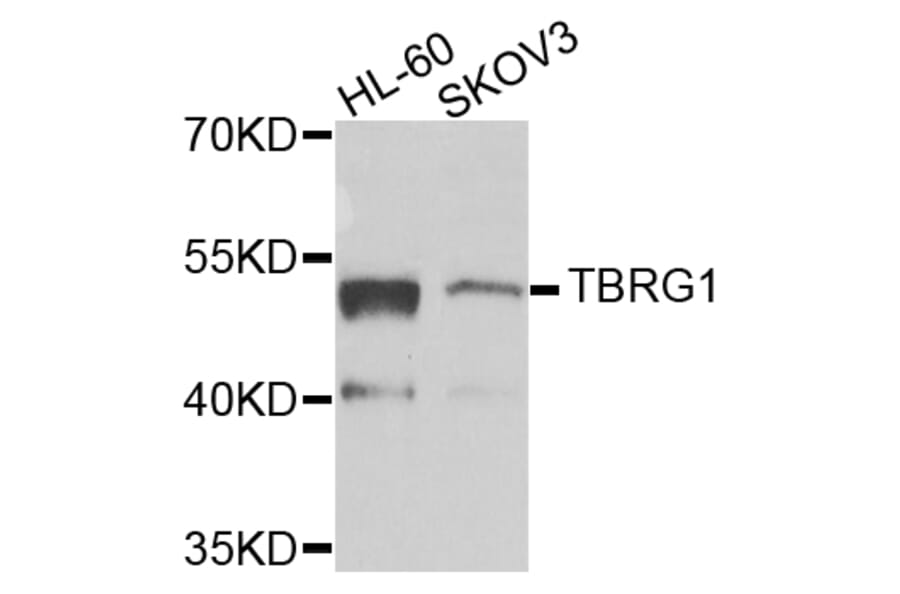 Western Blot - Anti-TBRG1 Antibody (A7164) - Antibodies.com