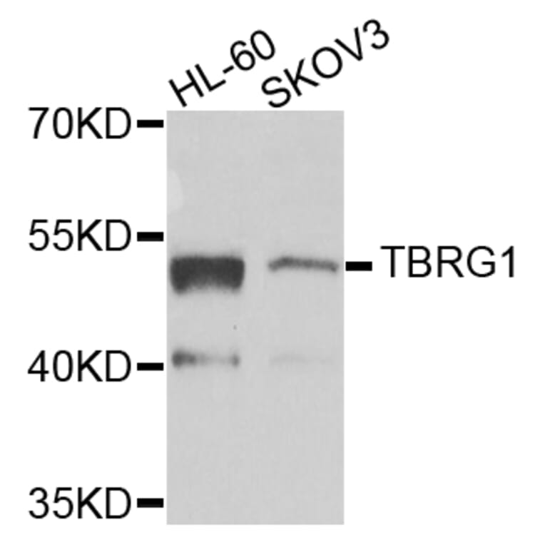 Western Blot - Anti-TBRG1 Antibody (A7164) - Antibodies.com