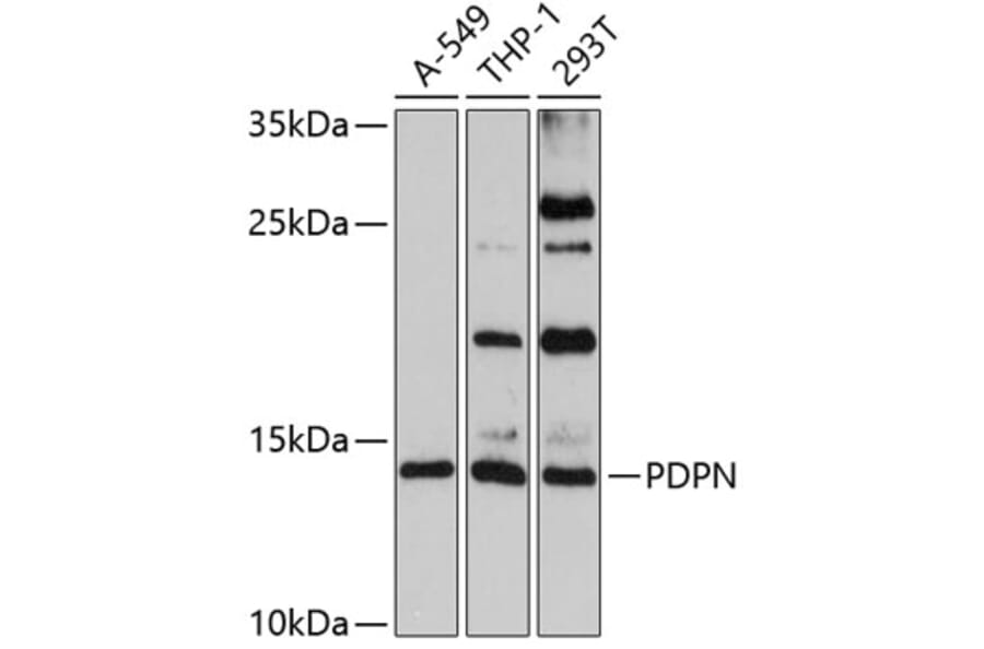 Western Blot - Anti-PDPN Antibody (A7166) - Antibodies.com