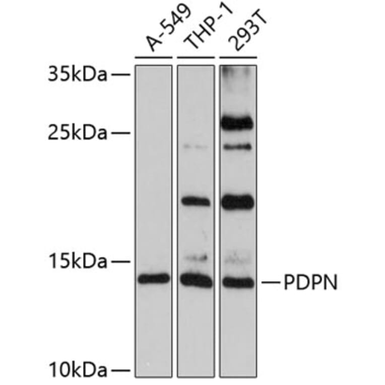 Western Blot - Anti-PDPN Antibody (A7166) - Antibodies.com