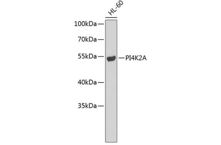 Western Blot - Anti-PI4K2A Antibody (A7168) - Antibodies.com