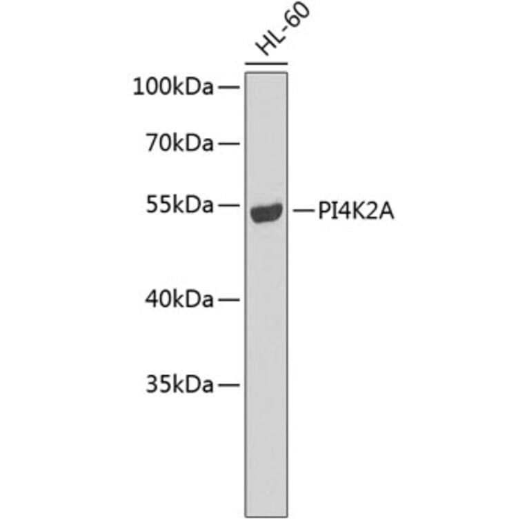Western Blot - Anti-PI4K2A Antibody (A7168) - Antibodies.com