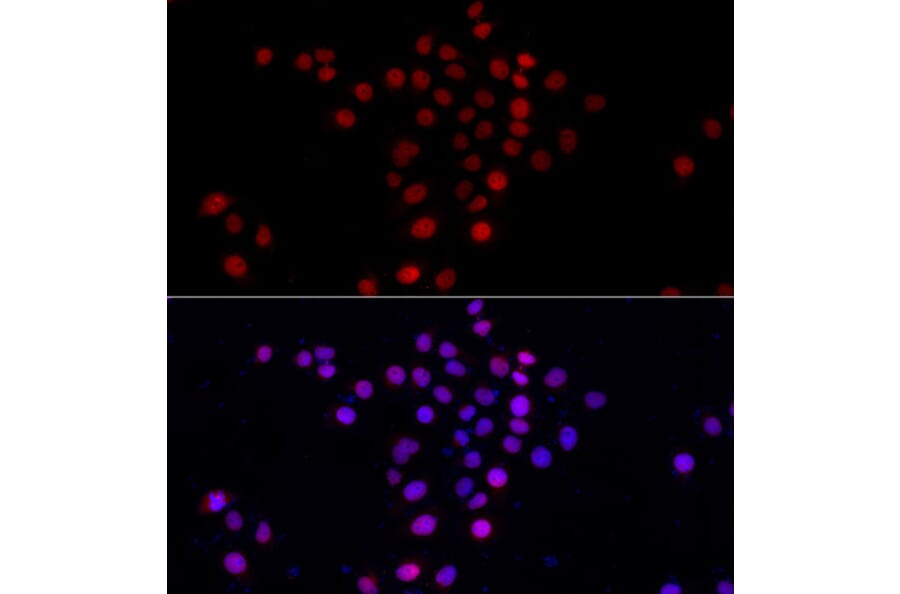 Immunofluorescence - Anti-PI4K2A Antibody (A7168) - Antibodies.com
