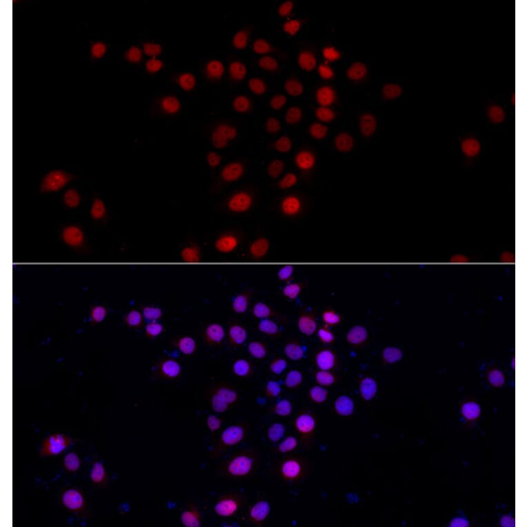 Immunofluorescence - Anti-PI4K2A Antibody (A7168) - Antibodies.com