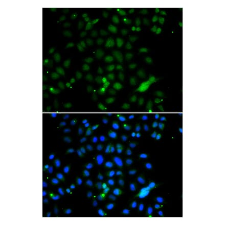 Immunofluorescence - Anti-ELF4 Antibody (A7180) - Antibodies.com