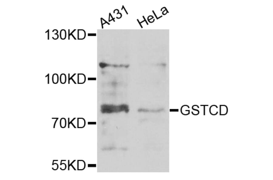 Western Blot - Anti-GSTCD Antibody (A7187) - Antibodies.com