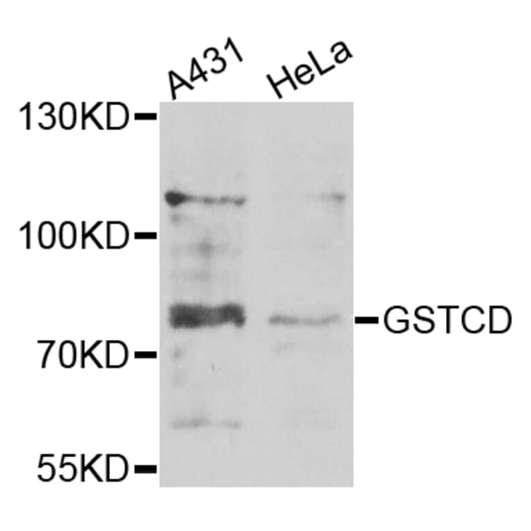 Western Blot - Anti-GSTCD Antibody (A7187) - Antibodies.com