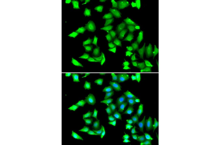 Immunofluorescence - Anti-GSTCD Antibody (A7187) - Antibodies.com