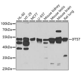 Western Blot - Anti-IFT57 Antibody (A7191) - Antibodies.com