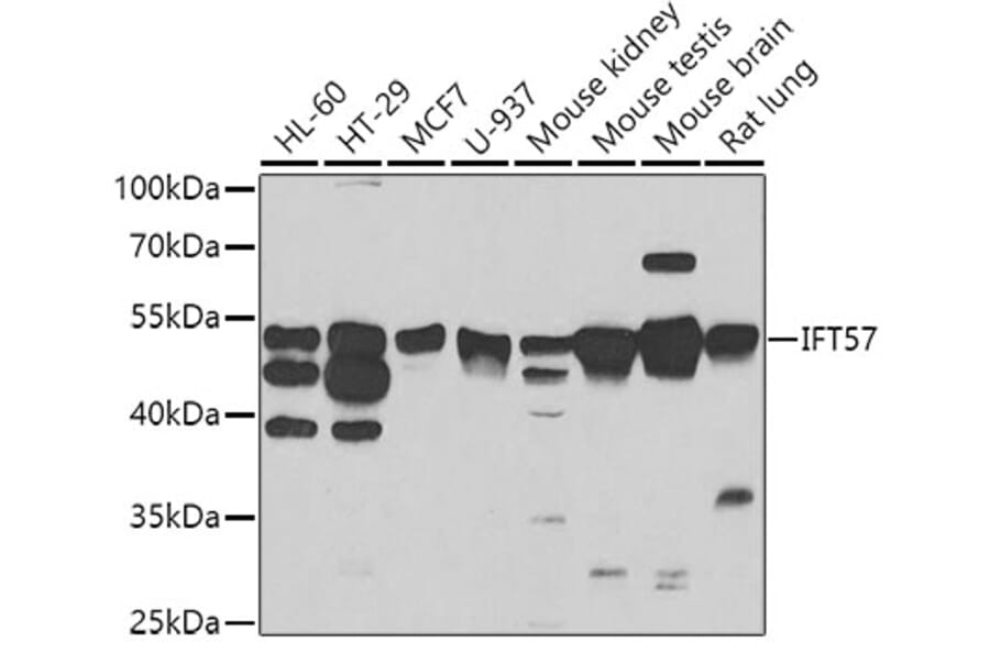 Western Blot - Anti-IFT57 Antibody (A7191) - Antibodies.com