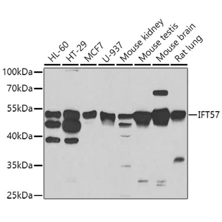 Western Blot - Anti-IFT57 Antibody (A7191) - Antibodies.com