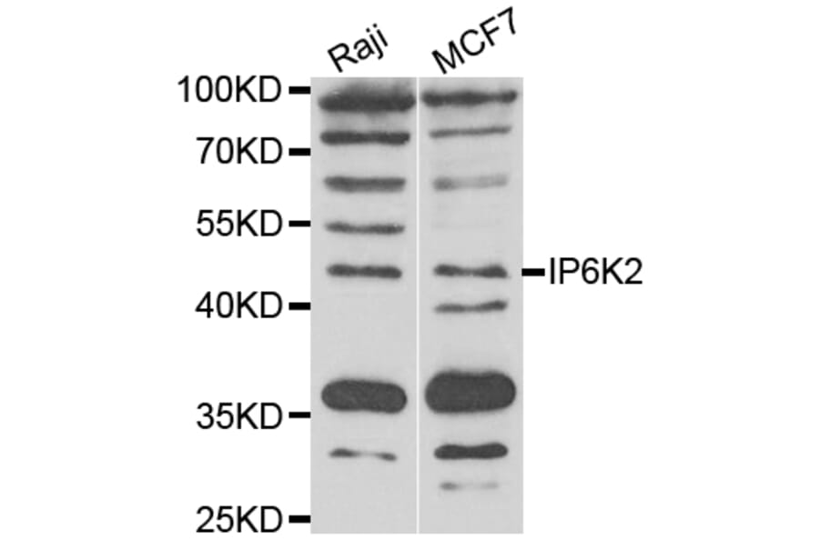 Western Blot - Anti-IP6K2 Antibody (A7192) - Antibodies.com