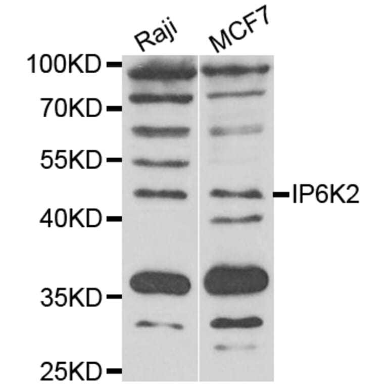 Western Blot - Anti-IP6K2 Antibody (A7192) - Antibodies.com