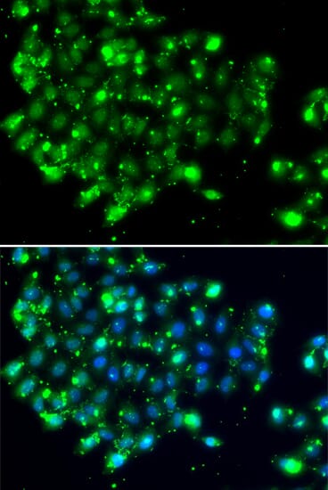 Immunofluorescence analysis of MCF-7 cells using Anti-NAT9 Antibody (A7204). Blue: DAPI for nuclear staining.