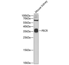 Western Blot - Anti-TERP Antibody (A10084) - Antibodies.com