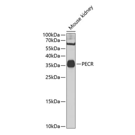 Western Blot - Anti-TERP Antibody (A10084) - Antibodies.com
