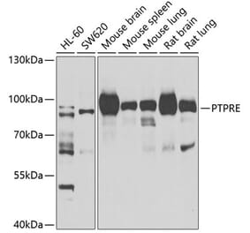 Western Blot - Anti-PTPRE Antibody (A10085) - Antibodies.com