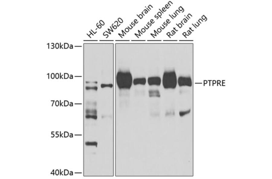 Western Blot - Anti-PTPRE Antibody (A10085) - Antibodies.com