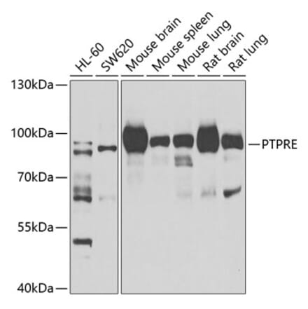 Western Blot - Anti-PTPRE Antibody (A10085) - Antibodies.com