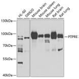 Western Blot - Anti-PTPRE Antibody (A10085) - Antibodies.com