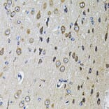 Immunohistochemistry - Anti-PTPRE Antibody (A10085) - Antibodies.com