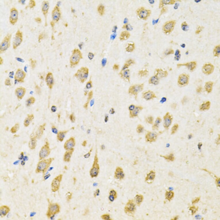 Immunohistochemistry - Anti-PTPRE Antibody (A10085) - Antibodies.com