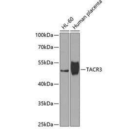 Western Blot - Anti-Neurokinin B Receptor Antibody (A10086) - Antibodies.com