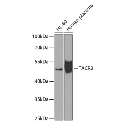 Western Blot - Anti-Neurokinin B Receptor Antibody (A10086) - Antibodies.com
