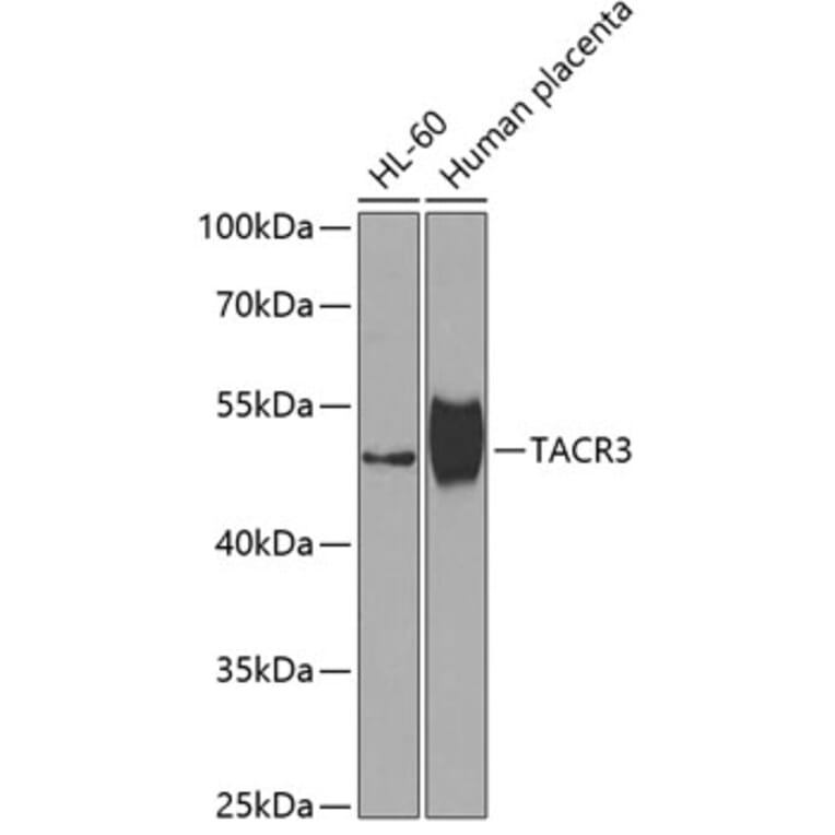 Western Blot - Anti-Neurokinin B Receptor Antibody (A10086) - Antibodies.com