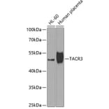 Western Blot - Anti-Neurokinin B Receptor Antibody (A10086) - Antibodies.com