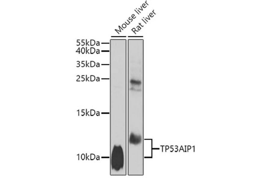Western Blot - Anti-p53 AIP1 Antibody (A10087) - Antibodies.com