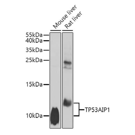Western Blot - Anti-p53 AIP1 Antibody (A10087) - Antibodies.com