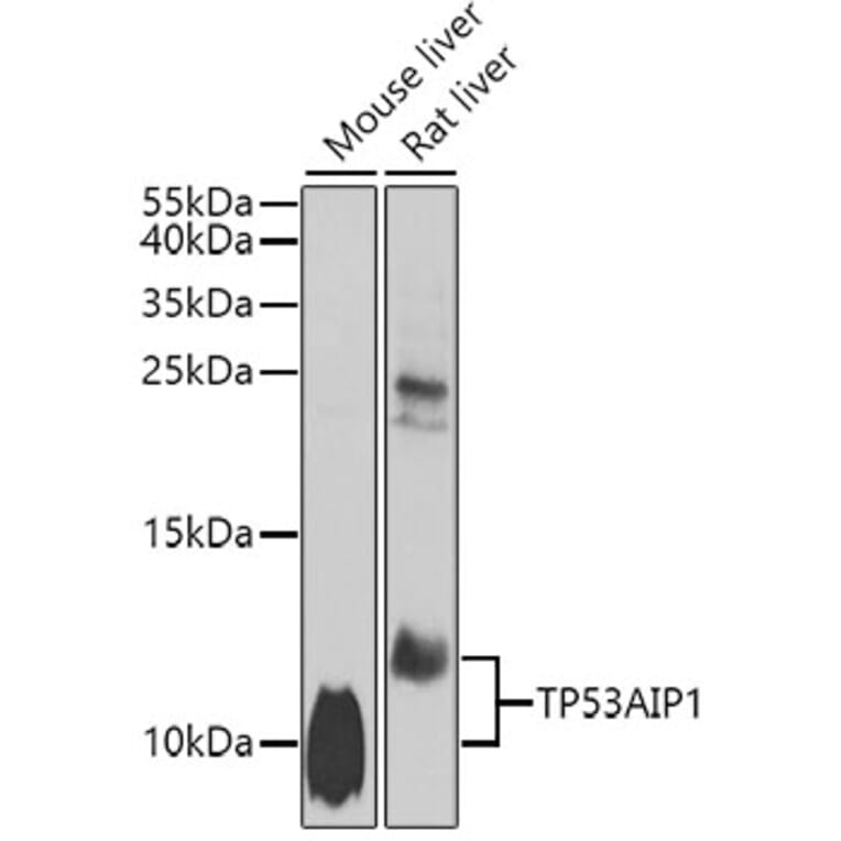 Western Blot - Anti-p53 AIP1 Antibody (A10087) - Antibodies.com