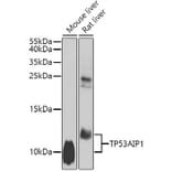 Western Blot - Anti-p53 AIP1 Antibody (A10087) - Antibodies.com