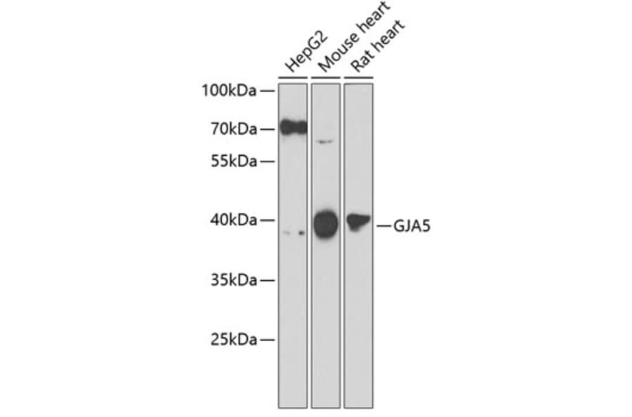 Western Blot - Anti-Cx40/GJA5 Antibody (A10088) - Antibodies.com