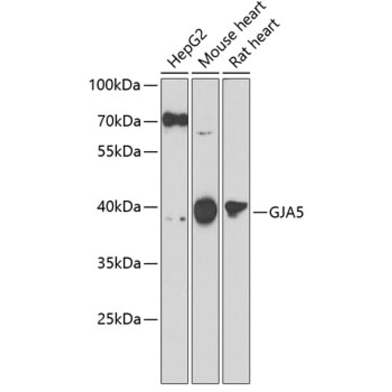 Western Blot - Anti-Cx40/GJA5 Antibody (A10088) - Antibodies.com