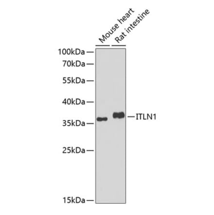 Western Blot - Anti-ITLN1 Antibody (A10089) - Antibodies.com