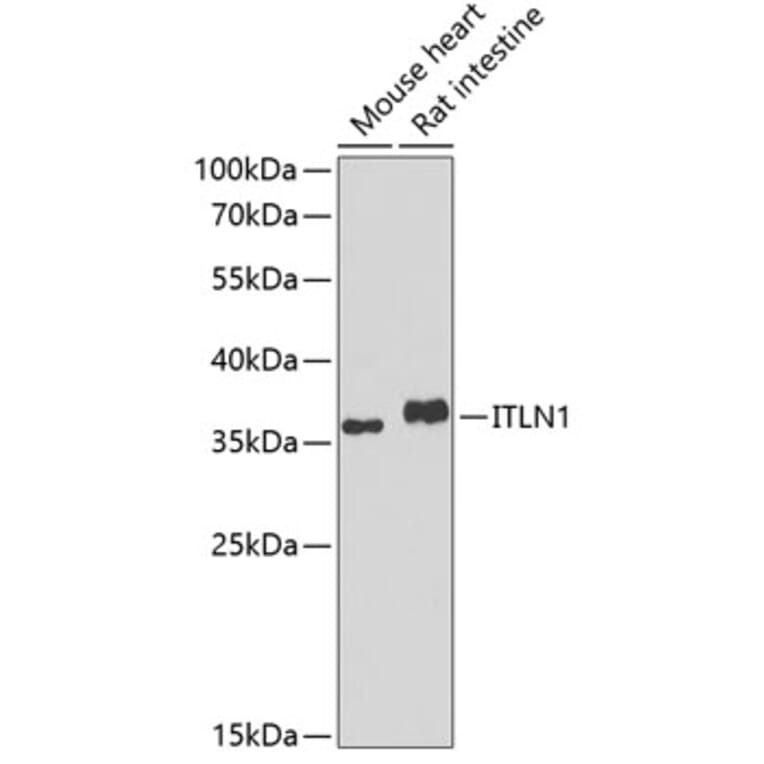 Western Blot - Anti-ITLN1 Antibody (A10089) - Antibodies.com