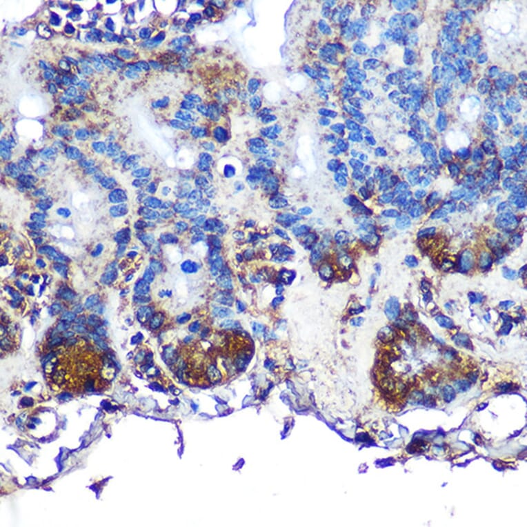 Immunohistochemistry - Anti-ITLN1 Antibody (A10089) - Antibodies.com